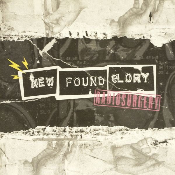 New Found Glory - Radiosurgery (COLOR VINYL) ((Vinyl))